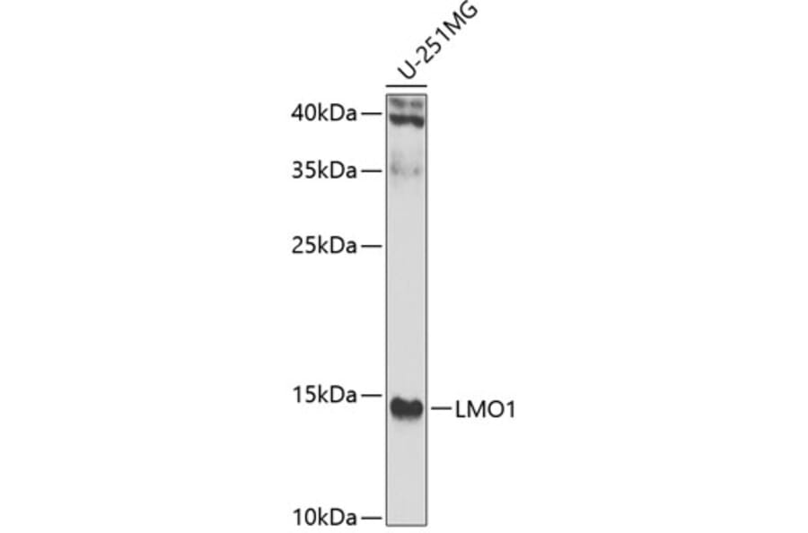 Western Blot - Anti-LMO1 Antibody (A15781) - Antibodies.com
