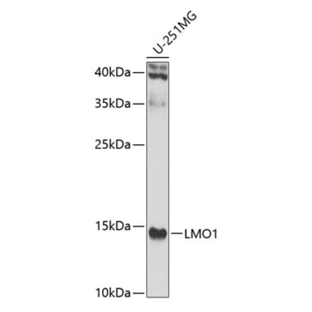 Western Blot - Anti-LMO1 Antibody (A15781) - Antibodies.com