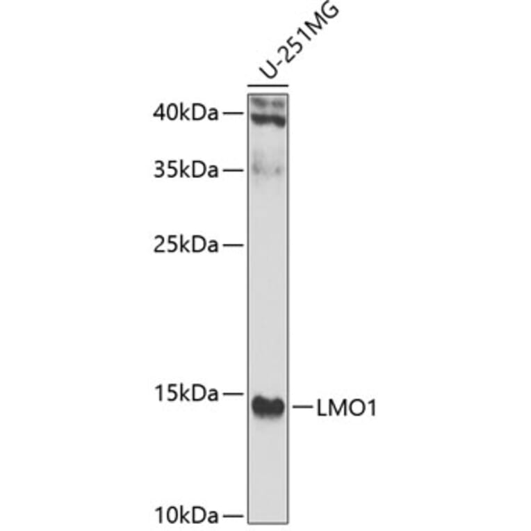 Western Blot - Anti-LMO1 Antibody (A15781) - Antibodies.com