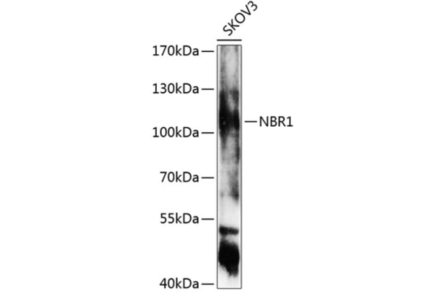 Western Blot - Anti-NBR1 Antibody (A7562) - Antibodies.com