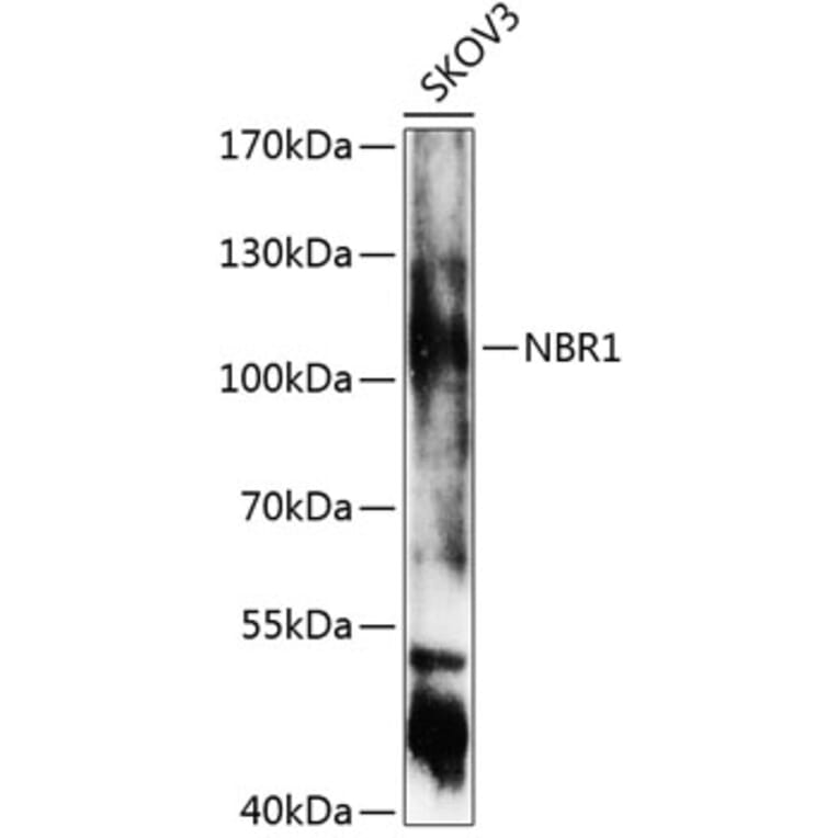 Western Blot - Anti-NBR1 Antibody (A7562) - Antibodies.com