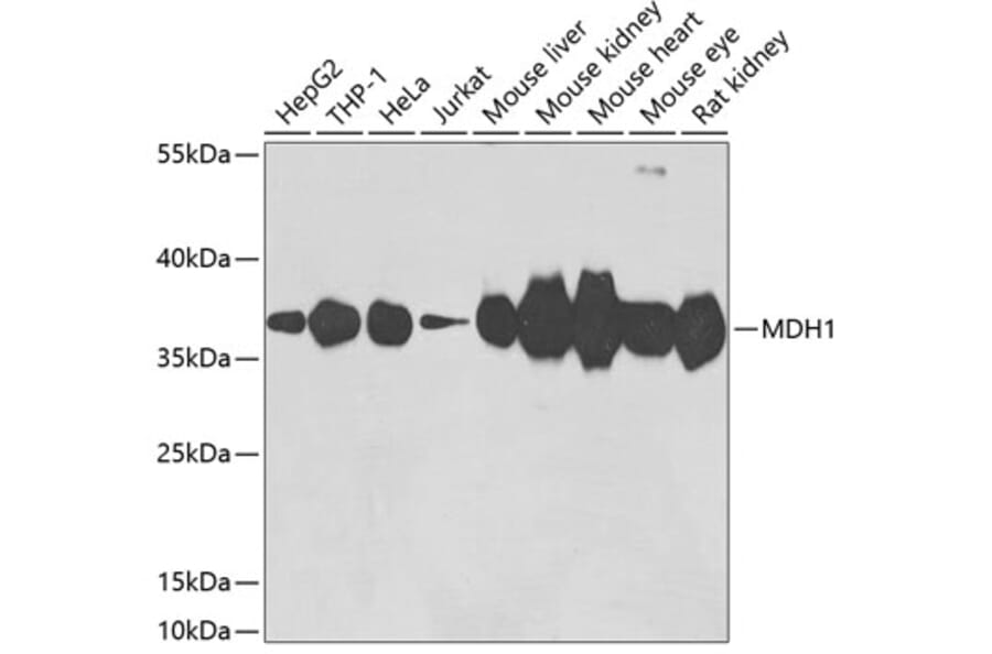 Western Blot - Anti-MDH1 Antibody (A15783) - Antibodies.com