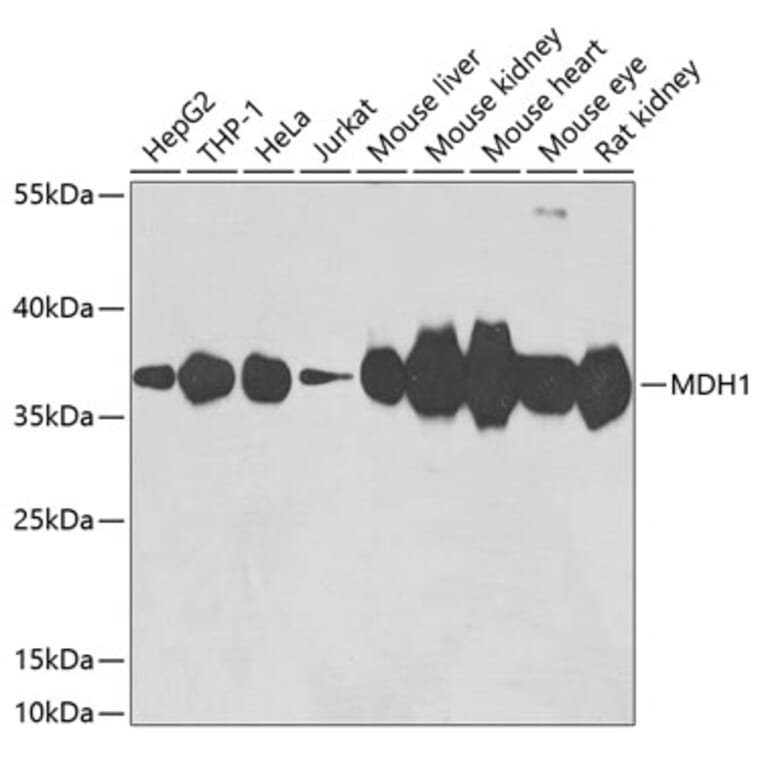 Western Blot - Anti-MDH1 Antibody (A15783) - Antibodies.com