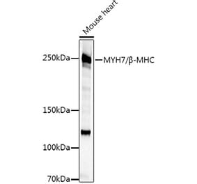 Western Blot - Anti-Slow Skeletal Myosin Heavy chain Antibody (A15784) - Antibodies.com
