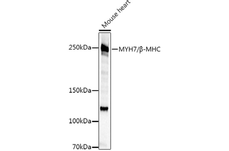 Western Blot - Anti-Slow Skeletal Myosin Heavy chain Antibody (A15784) - Antibodies.com