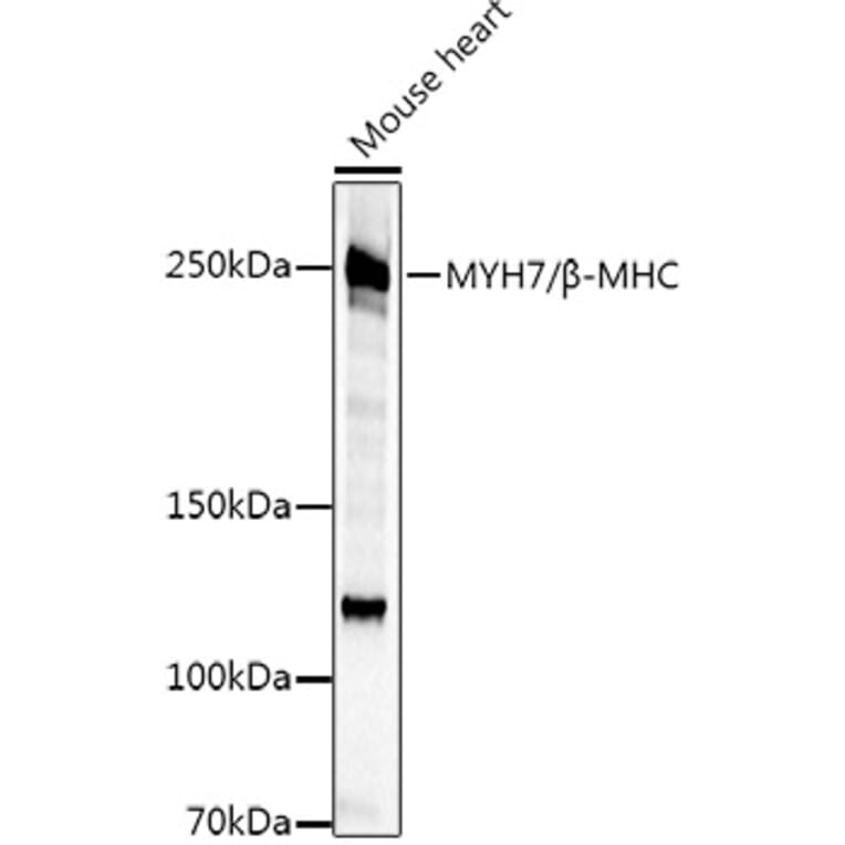 Western Blot - Anti-Slow Skeletal Myosin Heavy chain Antibody (A15784) - Antibodies.com