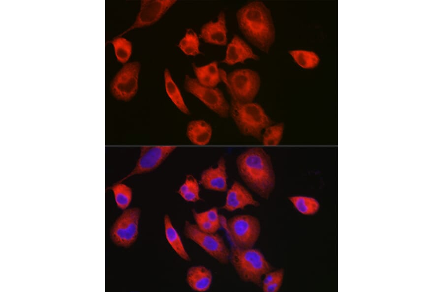Immunofluorescence - Anti-Slow Skeletal Myosin Heavy chain Antibody (A15784) - Antibodies.com