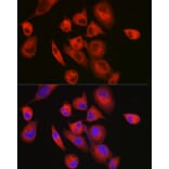 Immunofluorescence - Anti-Slow Skeletal Myosin Heavy chain Antibody (A15784) - Antibodies.com
