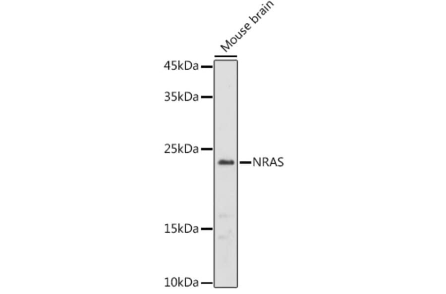 Western Blot - Anti-NRAS Antibody (A15785) - Antibodies.com