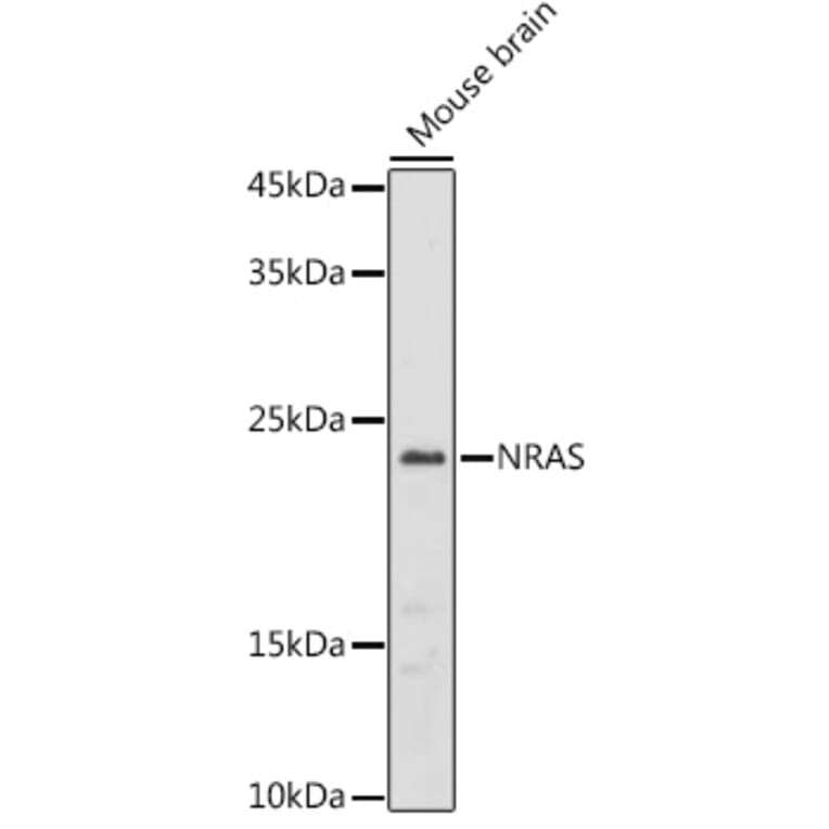 Western Blot - Anti-NRAS Antibody (A15785) - Antibodies.com