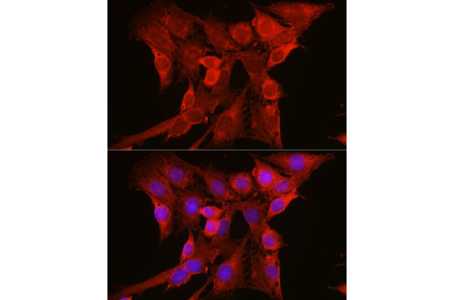 Immunofluorescence - Anti-NRAS Antibody (A15785) - Antibodies.com