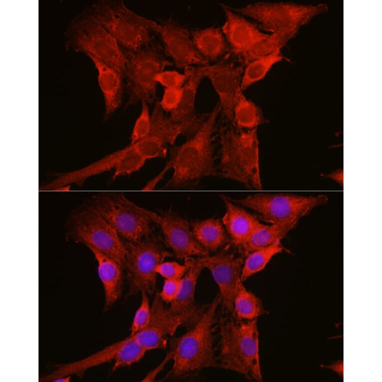 Immunofluorescence - Anti-NRAS Antibody (A15785) - Antibodies.com