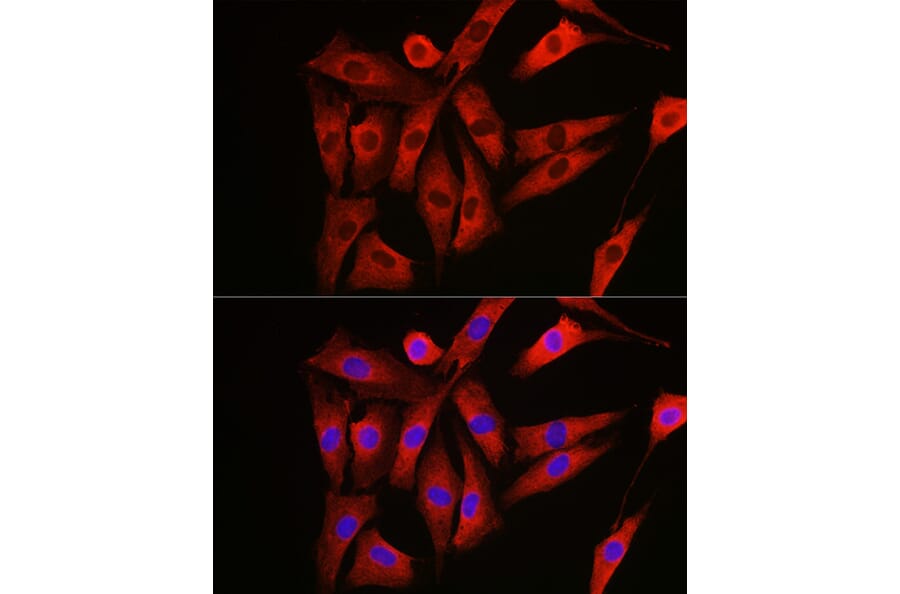Immunofluorescence - Anti-NRAS Antibody (A15785) - Antibodies.com