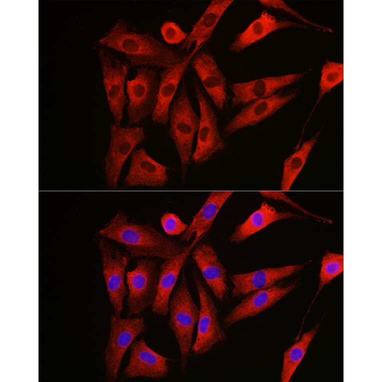 Immunofluorescence - Anti-NRAS Antibody (A15785) - Antibodies.com