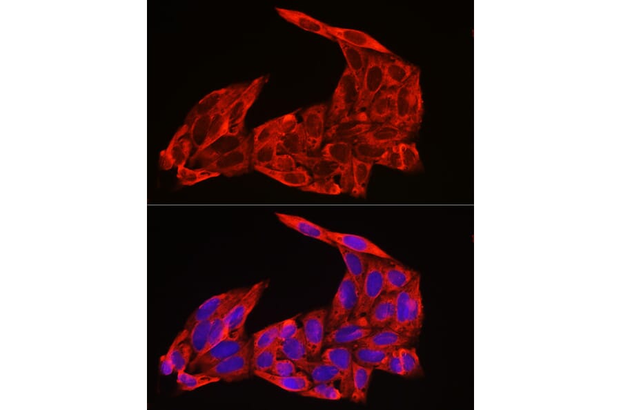 Immunofluorescence - Anti-NRAS Antibody (A15785) - Antibodies.com