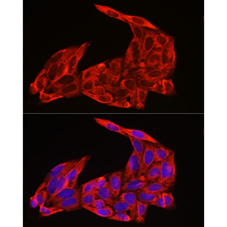 Immunofluorescence - Anti-NRAS Antibody (A15785) - Antibodies.com