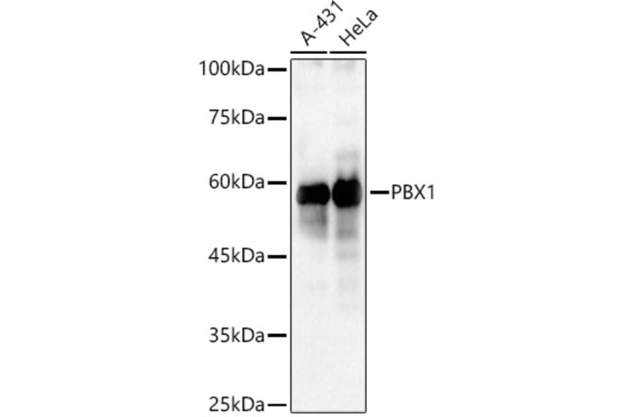 Western Blot - Anti-PBX1/PRL Antibody (A15786) - Antibodies.com