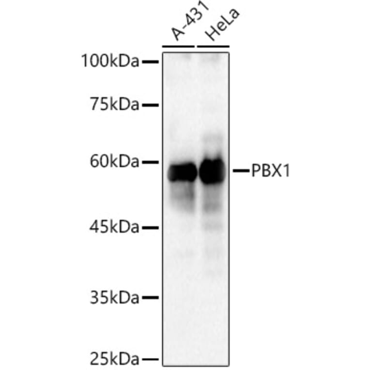 Western Blot - Anti-PBX1/PRL Antibody (A15786) - Antibodies.com