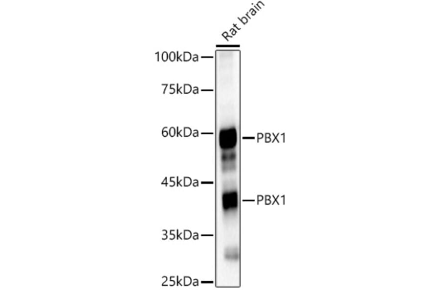Western Blot - Anti-PBX1/PRL Antibody (A15786) - Antibodies.com