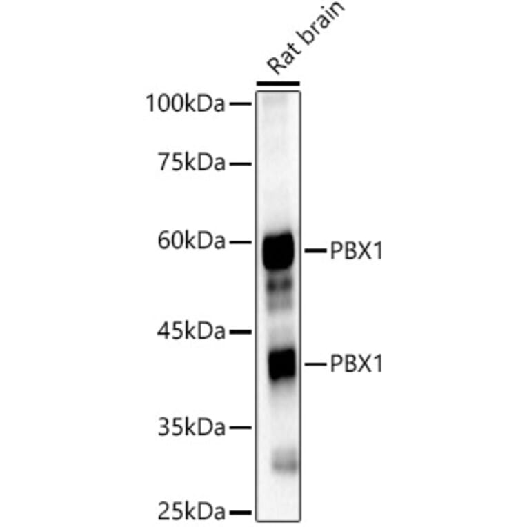 Western Blot - Anti-PBX1/PRL Antibody (A15786) - Antibodies.com