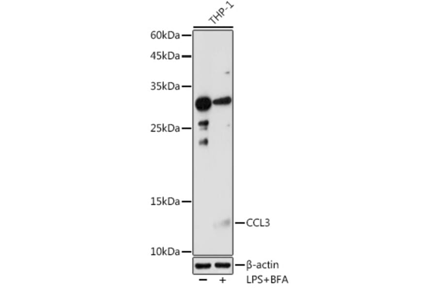 Western Blot - Anti-MIP-1 alpha/CCL3 Antibody (A15787) - Antibodies.com