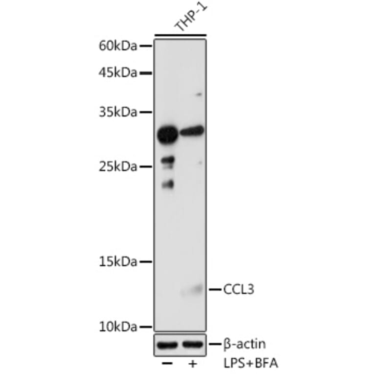 Western Blot - Anti-MIP-1 alpha/CCL3 Antibody (A15787) - Antibodies.com