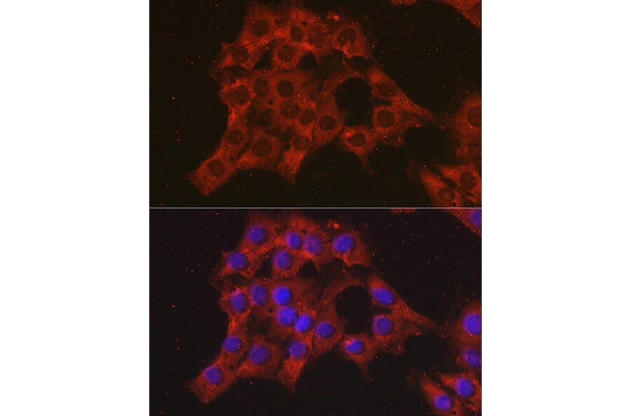 Immunofluorescence - Anti-MIP-1 alpha/CCL3 Antibody (A15787) - Antibodies.com