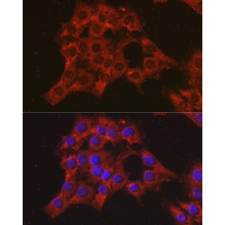 Immunofluorescence - Anti-MIP-1 alpha/CCL3 Antibody (A15787) - Antibodies.com