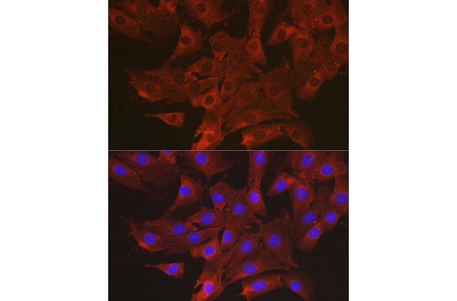 Immunofluorescence - Anti-MIP-1 alpha/CCL3 Antibody (A15787) - Antibodies.com