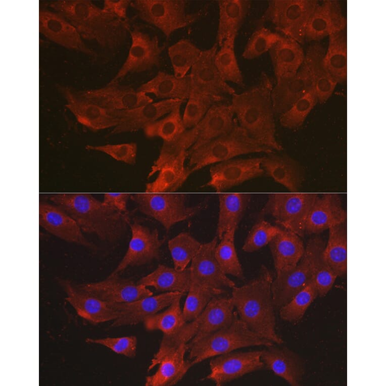 Immunofluorescence - Anti-MIP-1 alpha/CCL3 Antibody (A15787) - Antibodies.com