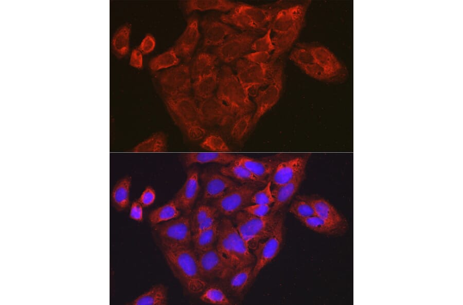 Immunofluorescence - Anti-MIP-1 alpha/CCL3 Antibody (A15787) - Antibodies.com
