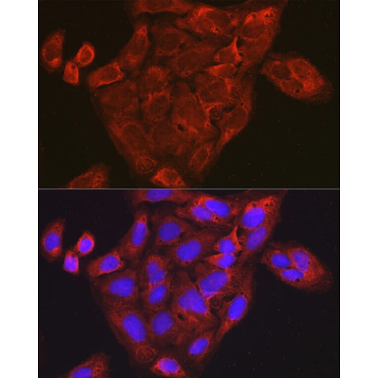 Immunofluorescence - Anti-MIP-1 alpha/CCL3 Antibody (A15787) - Antibodies.com