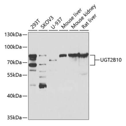 Western Blot - Anti-UGT2B10 Antibody (A15788) - Antibodies.com