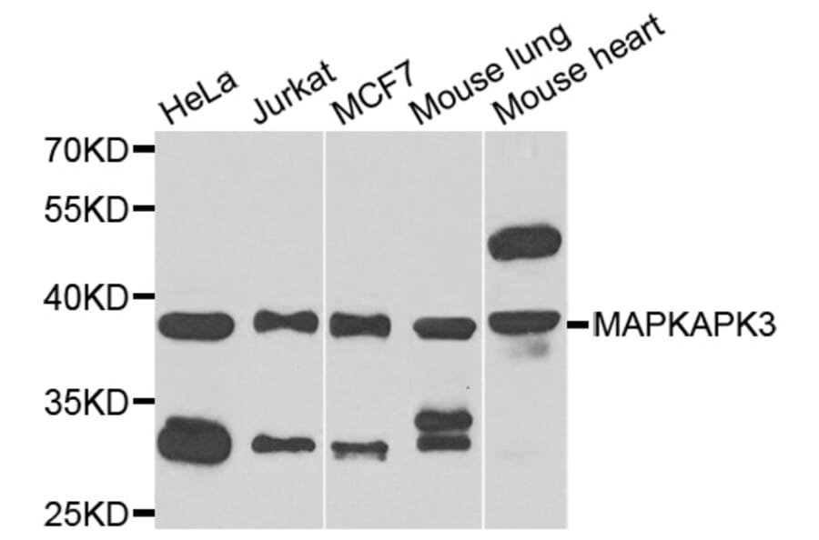 Western Blot - Anti-MAPKAPK3 Antibody (A7572) - Antibodies.com