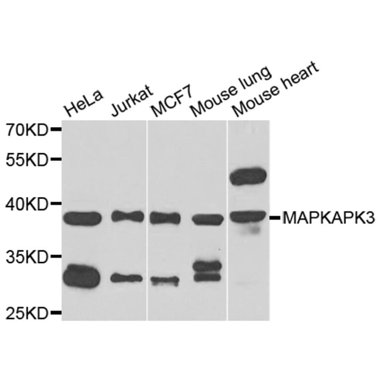 Western Blot - Anti-MAPKAPK3 Antibody (A7572) - Antibodies.com