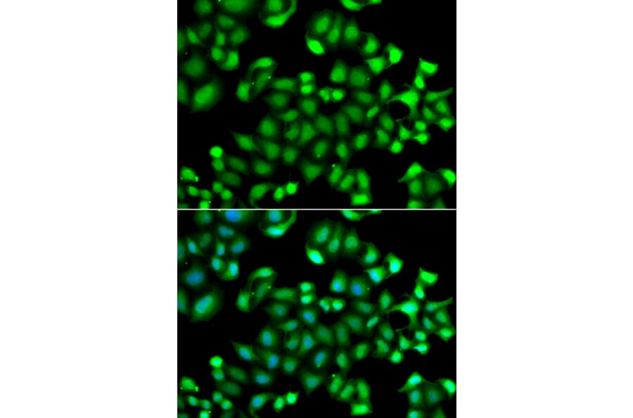 Immunofluorescence - Anti-MAPKAPK3 Antibody (A7572) - Antibodies.com