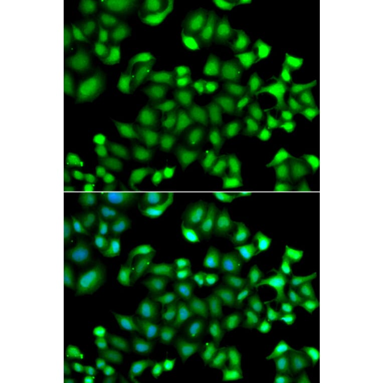 Immunofluorescence - Anti-MAPKAPK3 Antibody (A7572) - Antibodies.com