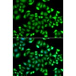 Immunofluorescence - Anti-MAPKAPK3 Antibody (A7572) - Antibodies.com