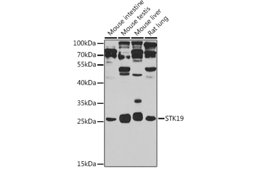 Western Blot - Anti-STK19/G11 Antibody (A15791) - Antibodies.com