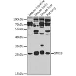 Western Blot - Anti-STK19/G11 Antibody (A15791) - Antibodies.com