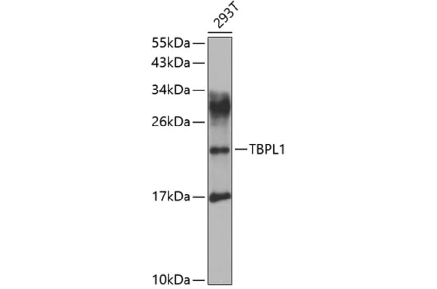 Western Blot - Anti-TBPlikeTLP Antibody (A15792) - Antibodies.com