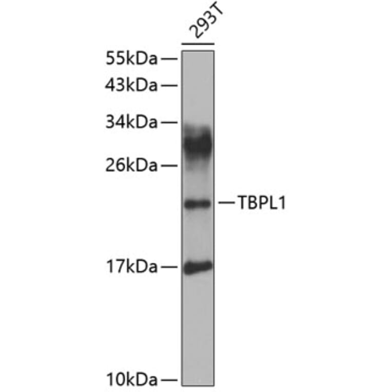 Western Blot - Anti-TBPlikeTLP Antibody (A15792) - Antibodies.com