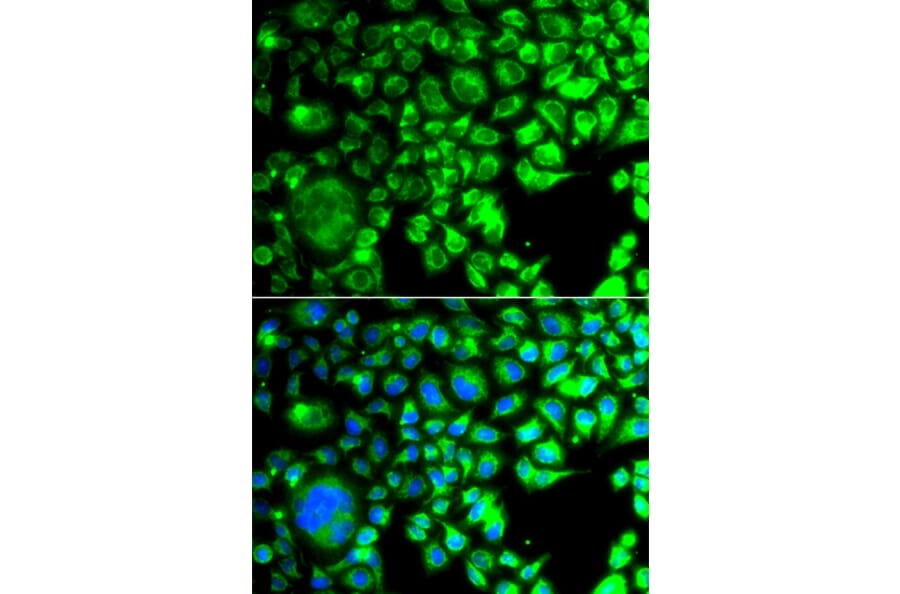 Immunofluorescence - Anti-TBPlikeTLP Antibody (A15792) - Antibodies.com