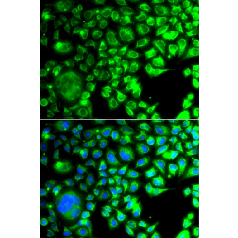 Immunofluorescence - Anti-TBPlikeTLP Antibody (A15792) - Antibodies.com