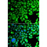 Immunofluorescence - Anti-TBPlikeTLP Antibody (A15792) - Antibodies.com