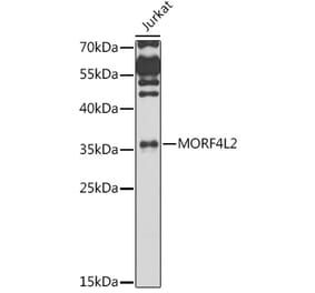 Western Blot - Anti-MRGX Antibody (A15794) - Antibodies.com