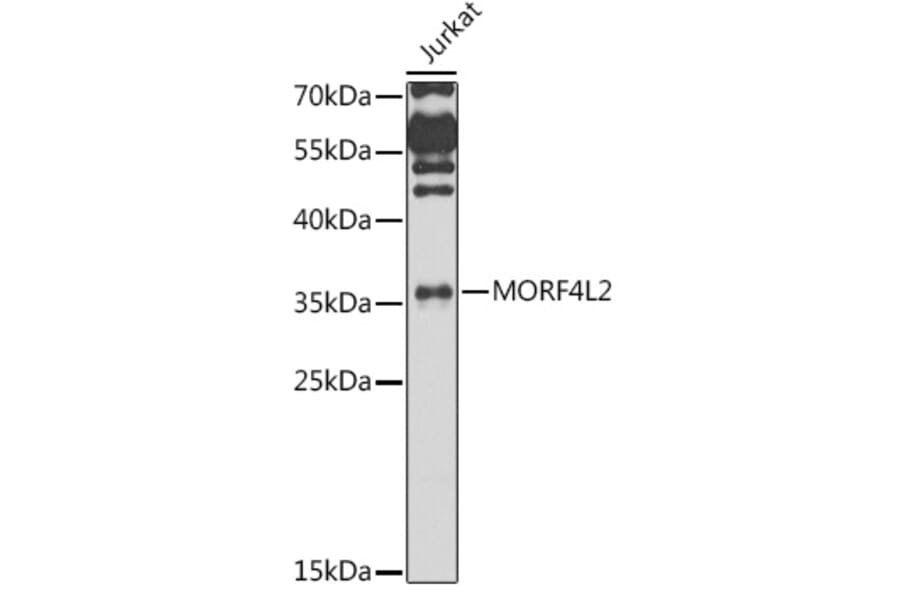 Western Blot - Anti-MRGX Antibody (A15794) - Antibodies.com