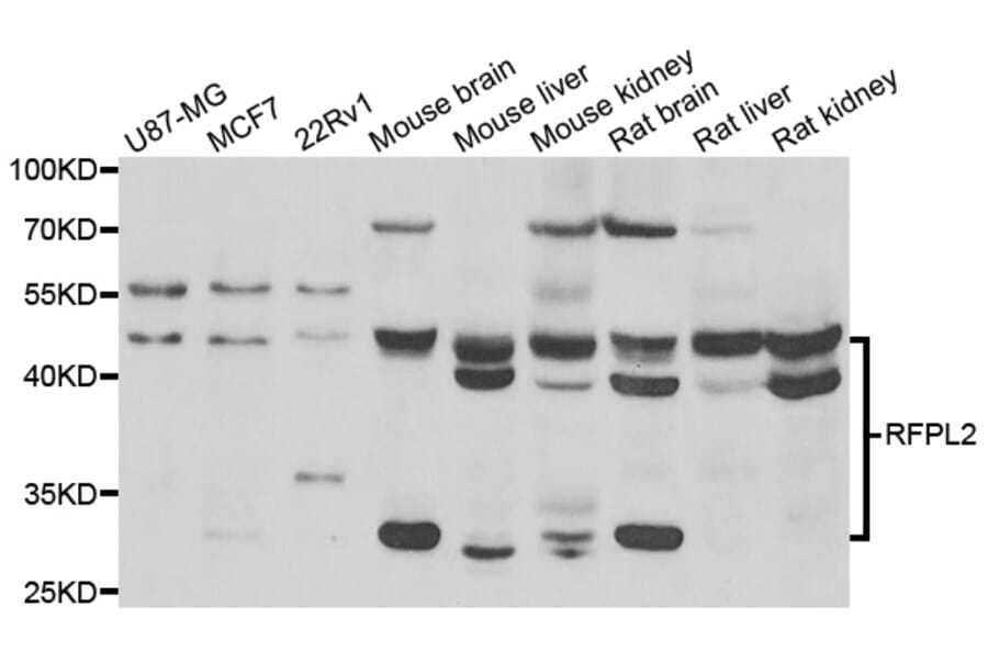 Western Blot - Anti-RFPL2 Antibody (A7578) - Antibodies.com