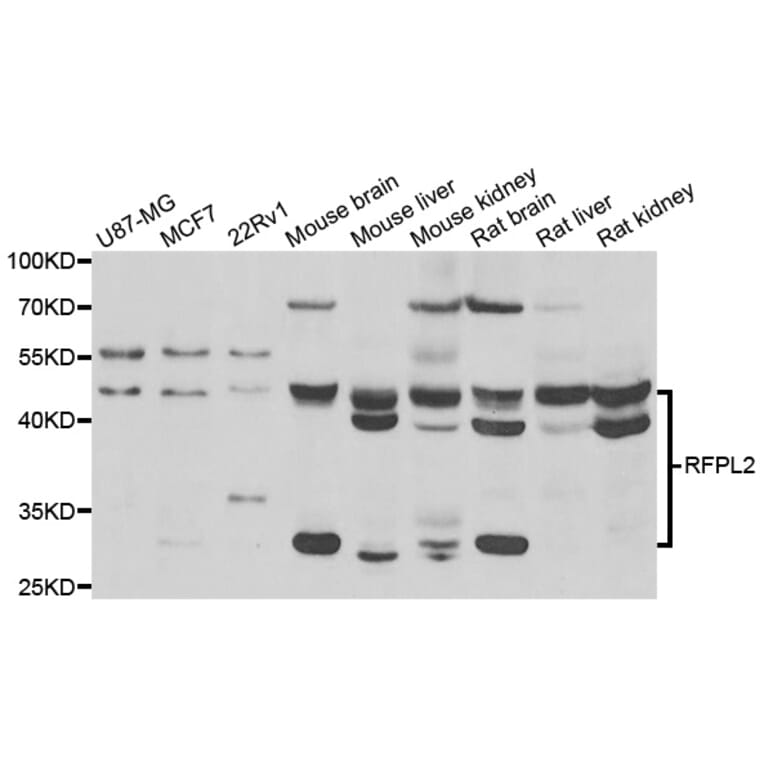 Western Blot - Anti-RFPL2 Antibody (A7578) - Antibodies.com