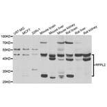 Western Blot - Anti-RFPL2 Antibody (A7578) - Antibodies.com
